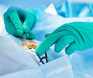 eyecare medical