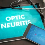 What are the warning signs of optic neuritis